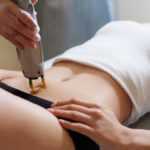 Lazernaya-epilyatsiya-zony-bikini-otzyvy-i-foto-640x384