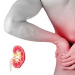 Урологічні захворювання urologicheskie-zabolevaniya1