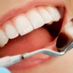 Чому важливо вчасно лікувати зуби та як уникнути серйозних ускладнень? sovremennye-metody-lecheniya-zubov-v-stomatologicheskoy-klinike-Bagita-v-Cherkassah-960x632