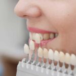 Реставрація зубів у Києві: сучасні методи та клініка Dentalwood vosstanovlenie-razrushenih-zubov